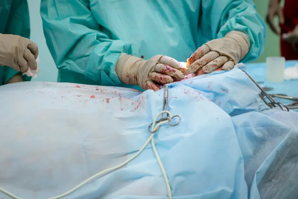 Breast Surgery Techniques